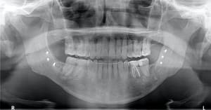 Egzxpkafikeccvoywzfu - Eugenol