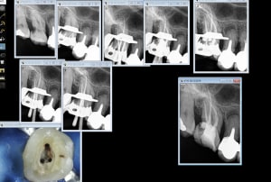 Endo 16 o8n4mg - Eugenol