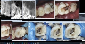 Endo 268 vgfehh - Eugenol