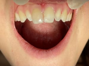 Er35kkkgbsif0dv6yd2j - Eugenol