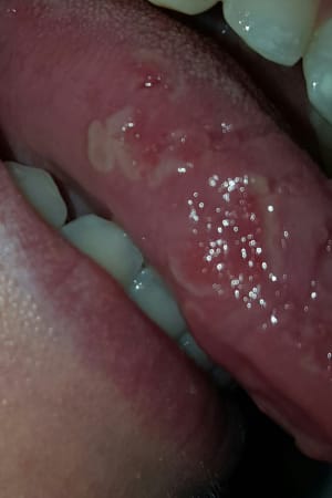 Esojfgmyixwmvmkausi0 - Eugenol