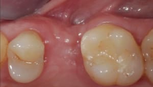 Eugenol - Eugenol