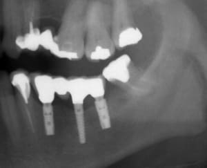 Euroteknika 3mm wdoyej - Eugenol