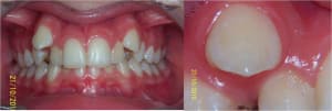 Exemple 1 fgu3od - Eugenol