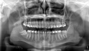 Exhncyrlxkylblw0jfni - Eugenol