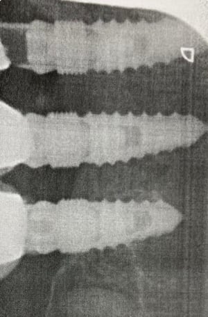 F0hsmlv2tryx4g5wzb5c6avxdqg3 - Eugenol