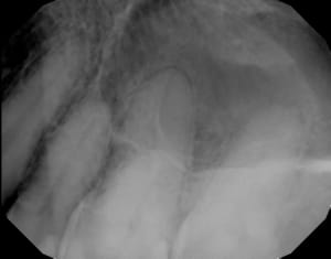 F5pp9mwi3s5vauy2prng - Eugenol