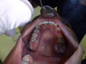 F6h7vxq5eqlgnuttbrvi - Eugenol