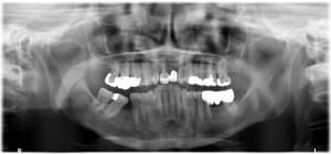 Fgglkexrvtimo7qlildb - Eugenol