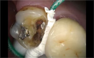 Fil2 b5v6tr - Eugenol