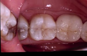Finition laygjo - Eugenol
