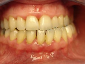 Fn1 mgmrhx - Eugenol