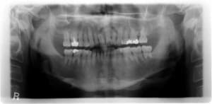 Fouill dzd2us - Eugenol