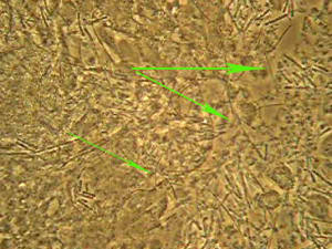 Fusobacterium liunss - Eugenol
