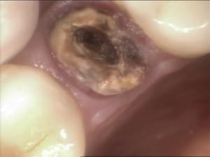 Gar2 tadsna - Eugenol