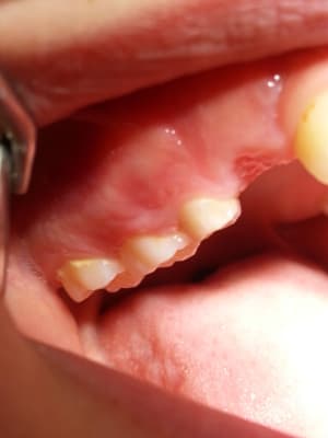 Garcon 11 ans iswlni - Eugenol