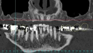 Gart panoramic1 ssmlda - Eugenol