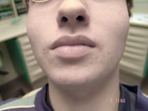 Genb kzx0m9 - Eugenol