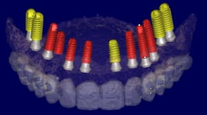 Georges 3d5 dvx9cb - Eugenol