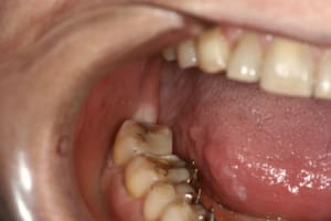 Grosse merde opw0bx - Eugenol