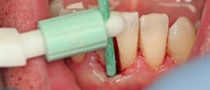 Gu  par gm5thx - Eugenol