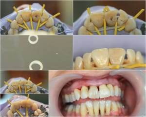 Haut njjy5t - Eugenol