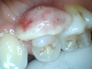 Hhuwhm6a9gerhycytewv - Eugenol