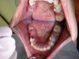 Hl5hxanusq2vnpnyyzp9 - Eugenol