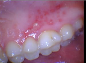 I3iyttzijsbp8etlb79u - Eugenol