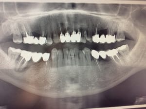 Image1 dratcq - Eugenol