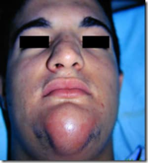 Image thumb311 cpbsga - Eugenol