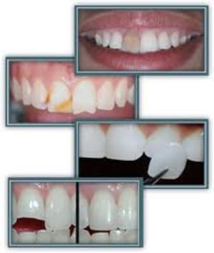 Imagesca9acedr beej6u - Eugenol