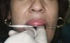 Images fox ggrsok - Eugenol