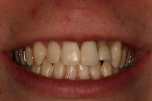 Img 7442 phqe0x - Eugenol