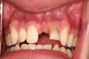 Img 7560 p75r4u - Eugenol