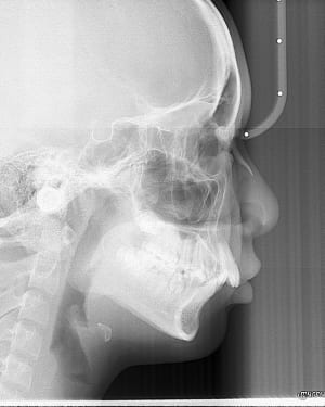 In6vtvzkm2lthqwidej5 - Eugenol