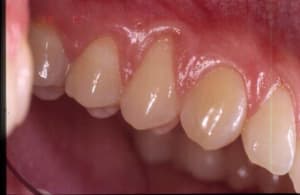 Initial qoccpw - Eugenol