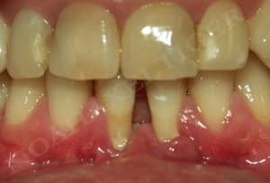 Initial wy0cig - Eugenol