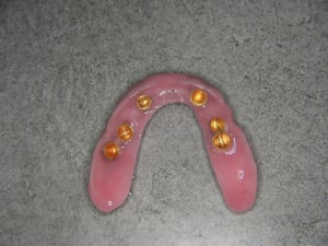 Intrados essayaeg cire tutagv - Eugenol