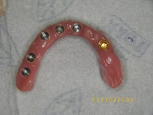 Intrados lu0h2x - Eugenol
