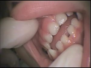 Inversé d w7xa0l - Eugenol