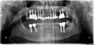 Iro st3dqy - Eugenol