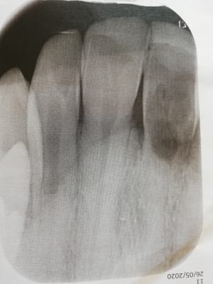 Iruakkrwdwjatrbi5tbm - Eugenol