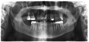 Jg1 ud0gdi - Eugenol