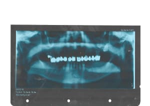 Jjz80uu3eumgq5wyiiss - Eugenol