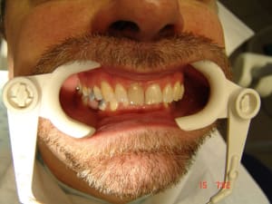 Kb1 kttu5q - Eugenol