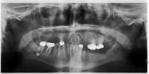 Kcfvc375qxul1ciefjo1c1apth00 - Eugenol