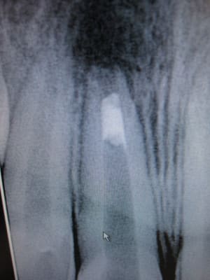 L o 2009 yrvpzp - Eugenol