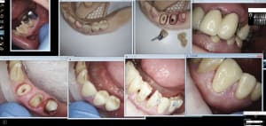 Labocast pose 33 34 35 rdggkr - Eugenol