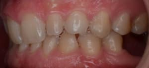 Lf0byhsbzq0i3rn3i2ml - Eugenol